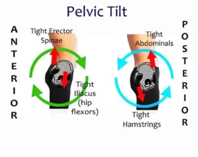 pelvic tilt and muscles