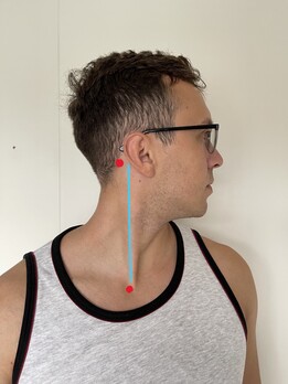 sternocleidomastoid location and attachment